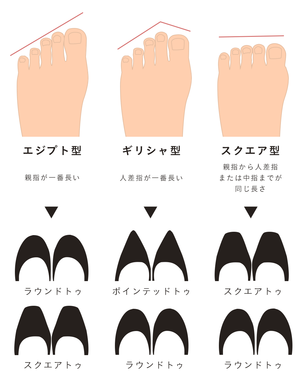 外反母趾の方におすすめ 足の形のタイプ